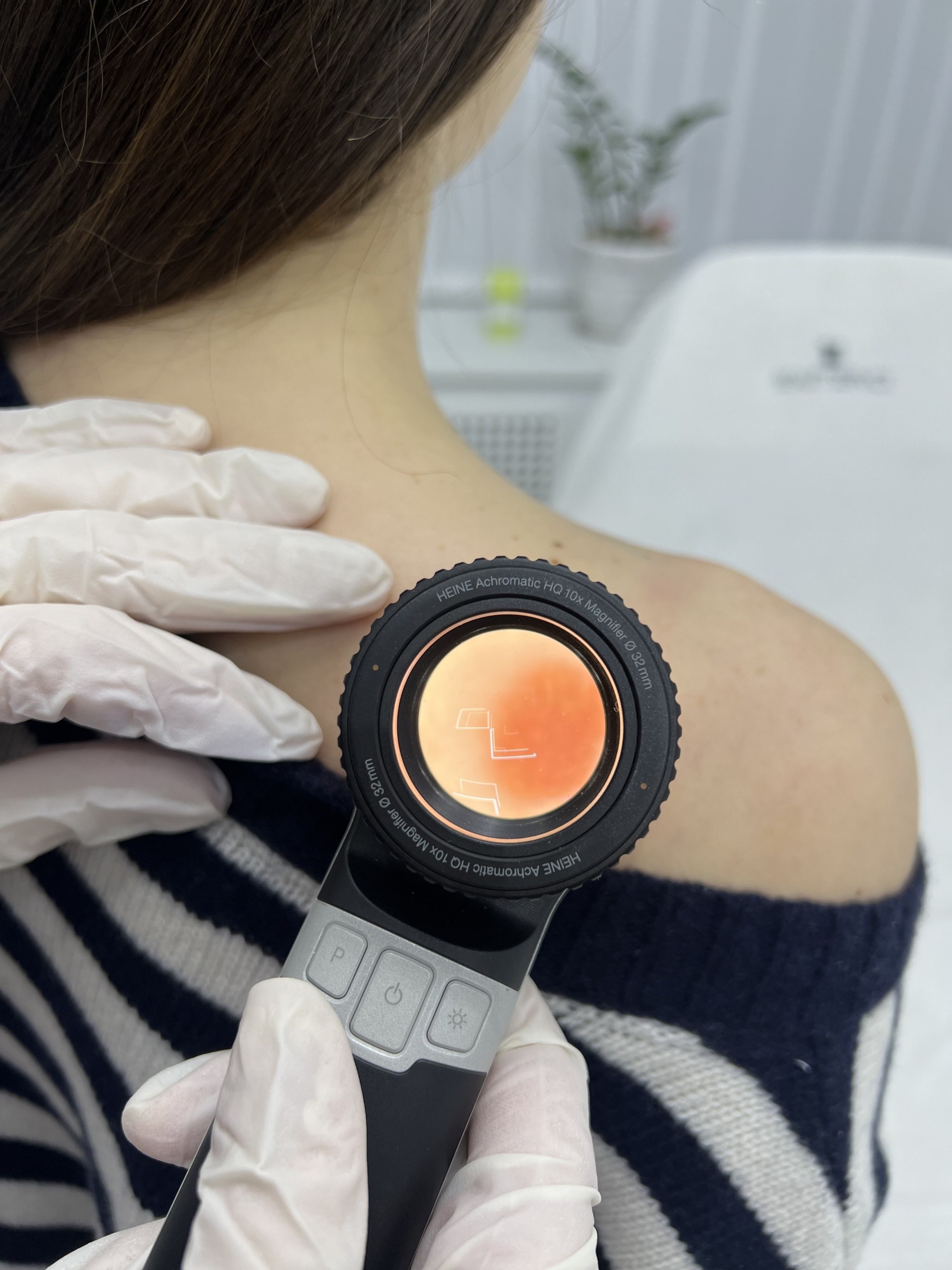 Дерматоспопія