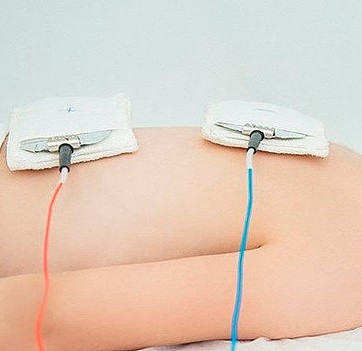 Електрофарез