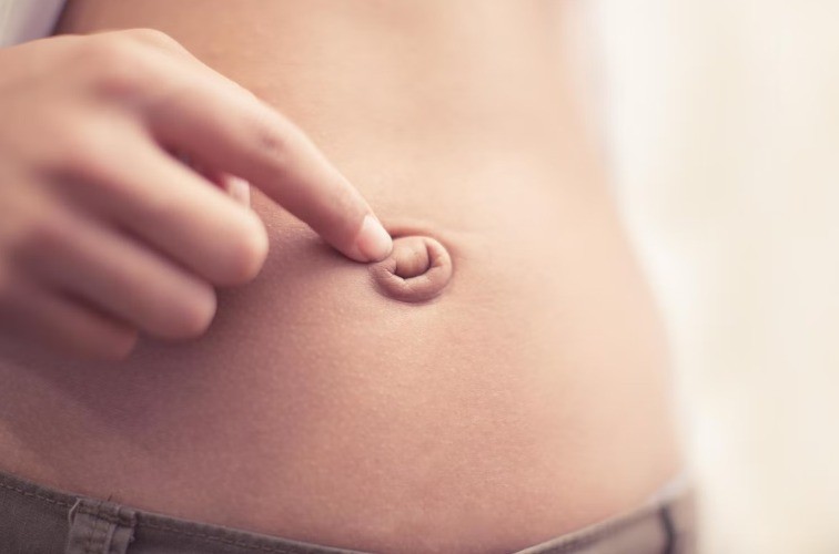 Пупочная грыжа