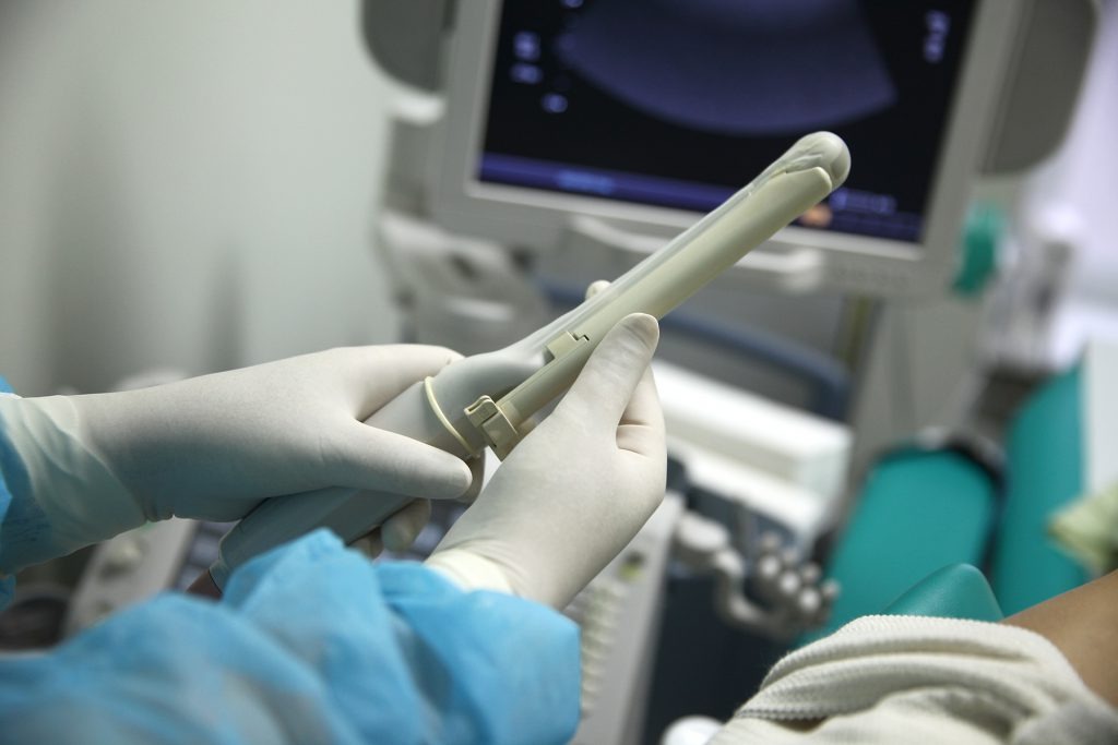 УЗИ органов малого таза