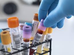 Неинвазивное пренатальное тестирование (НИПТ)