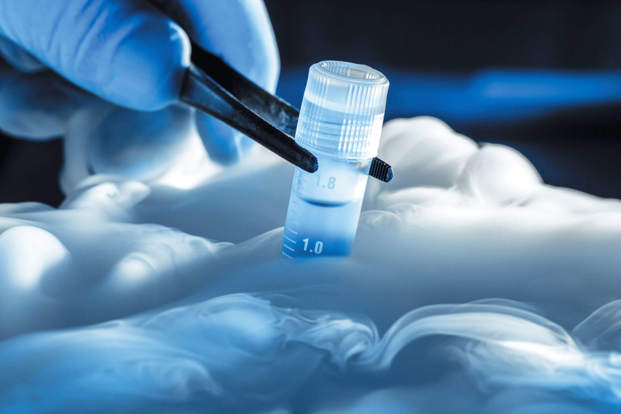 Перенос замороженных эмбрионов (криоперенос) Перенос замороженных эмбрионов (криоперенос)