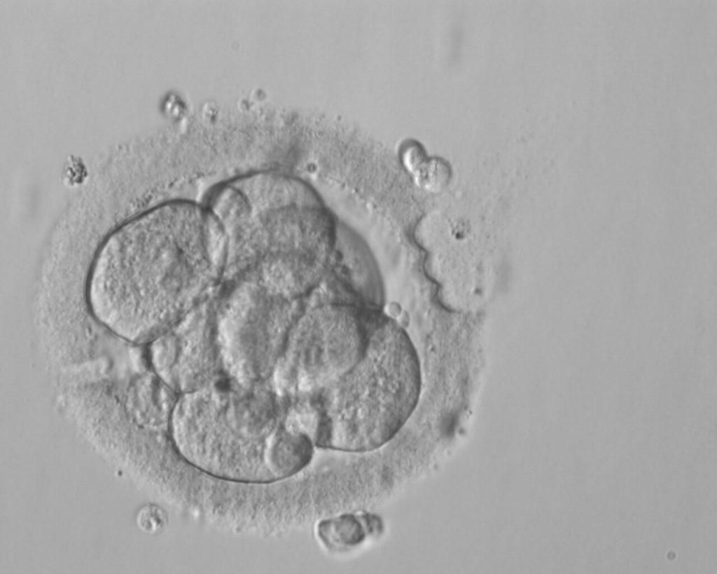 Перенос замороженных эмбрионов (Криоперенос) Перенос замороженных эмбрионов (Криоперенос)